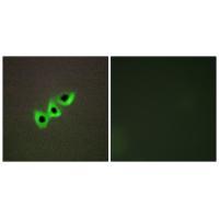Rabbit Polyclonal Antibody to RHG07