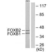 Rabbit Polyclonal Antibody to FOXB1/2