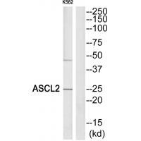 Rabbit Polyclonal Antibody to ASCL2