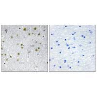 Rabbit Polyclonal Antibody to NRIP2
