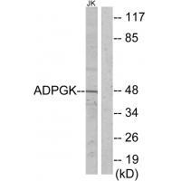 Rabbit Polyclonal Antibody to ADPGK