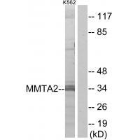 Rabbit Polyclonal Antibody to MMTA2