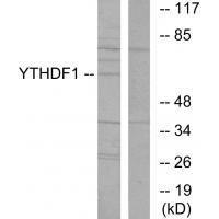 Rabbit Polyclonal Antibody to YTHDF1