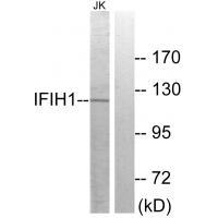 Rabbit Polyclonal Antibody to IFIH1