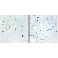 Rabbit Polyclonal Antibody to DCLK3