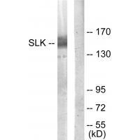Rabbit Polyclonal Antibody to SLK