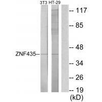 Rabbit Polyclonal Antibody to ZNF435
