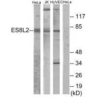 Rabbit Polyclonal Antibody to ES8L2