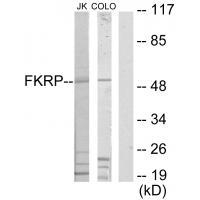 Rabbit Polyclonal Antibody to FKRP