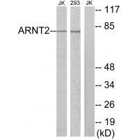 Rabbit Polyclonal Antibody to ARNT2