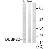 Rabbit Polyclonal Antibody to DUSP22