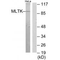 Rabbit Polyclonal Antibody to MLTK