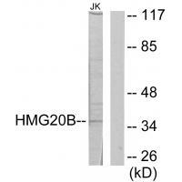 Rabbit Polyclonal Antibody to HMG20B