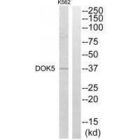 Rabbit Polyclonal Antibody to DOK5