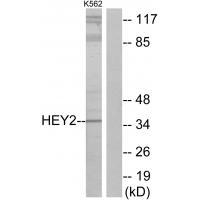 Rabbit Polyclonal Antibody to HEY2