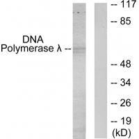 Rabbit Polyclonal Antibody to DNA Polymerase 位