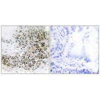 Rabbit Polyclonal Antibody to TRPS1
