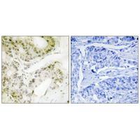 Rabbit Polyclonal Antibody to MED13