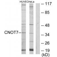 Rabbit Polyclonal Antibody to CNOT7