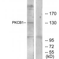 Rabbit Polyclonal Antibody to PKCB1