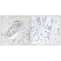 Rabbit Polyclonal Antibody to ZNF232