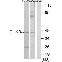 Rabbit Polyclonal Antibody to CHKB