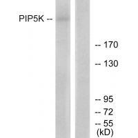 Rabbit Polyclonal Antibody to PIP5K