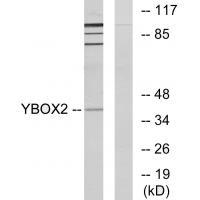 Rabbit Polyclonal Antibody to YBOX2