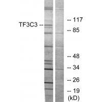 Rabbit Polyclonal Antibody to TF3C3