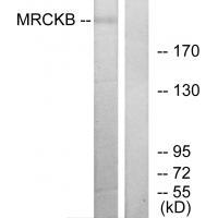 Rabbit Polyclonal Antibody to MRCKB