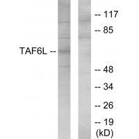 Rabbit Polyclonal Antibody to TAF6L