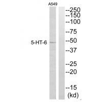 Rabbit Polyclonal Antibody to 5-HT-6