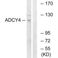 Rabbit Polyclonal Antibody to ADCY4