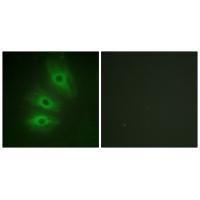 Rabbit Polyclonal Antibody to ADCY5/6