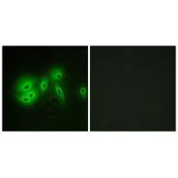 Rabbit Polyclonal Antibody to ADCY8