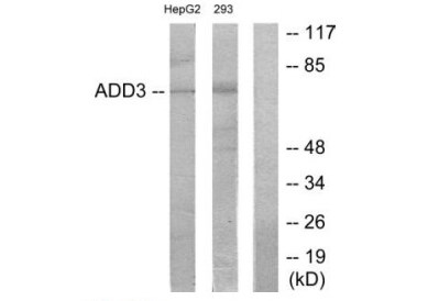 Rabbit Polyclonal Antibody to ADD3