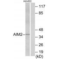Rabbit Polyclonal Antibody to AIM2