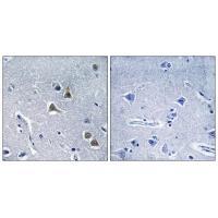 Rabbit Polyclonal Antibody to ARRDC2