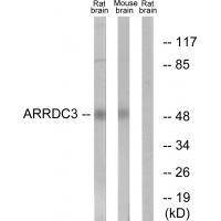 Rabbit Polyclonal Antibody to ARRDC3