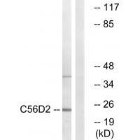 Rabbit Polyclonal Antibody to C56D2