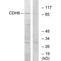 Rabbit Polyclonal Antibody to CDH8