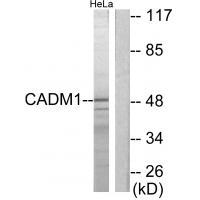 Rabbit Polyclonal Antibody to CADM1