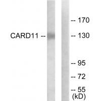 Rabbit Polyclonal Antibody to CARD11