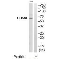 Rabbit Polyclonal Antibody to CDKAL
