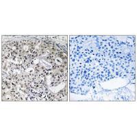 Rabbit Polyclonal Antibody to CNTD2