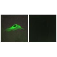 Rabbit Polyclonal Antibody to Collagen IV α5