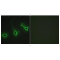 Rabbit Polyclonal Antibody to Collagen V α3