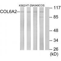 Rabbit Polyclonal Antibody to Collagen VI α2