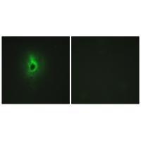 Rabbit Polyclonal Antibody to Collagen VI α3