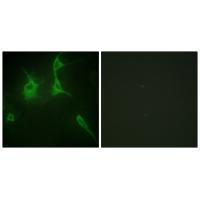 Rabbit Polyclonal Antibody to Collagen IX α3